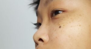 Read more about the article Jangan Salah Beli Produk, Ketahui 7 Manfaat Serum yang Sesuai untuk Wajah