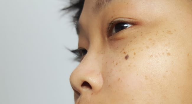 Read more about the article Jangan Salah Beli Produk, Ketahui 7 Manfaat Serum yang Sesuai untuk Wajah